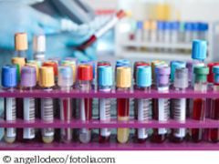 Weitere Fortschritte beim  Human-Biomonitoring
